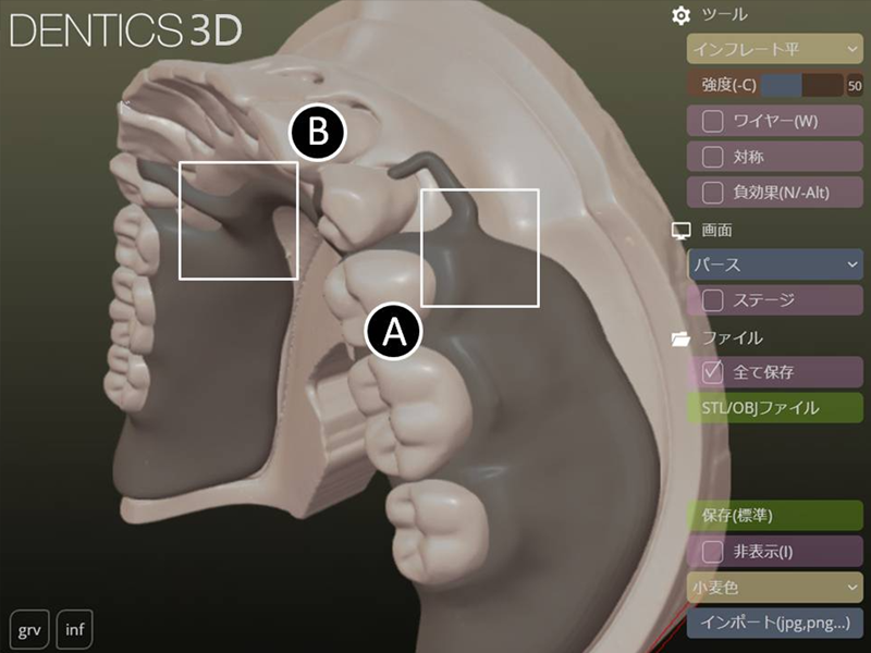 未開封　デンタルコーチング術セミナー　DVD3巻　　人材育成 未開封 デンタルコーチング術セミナー DVD3巻 人材育成 未開封